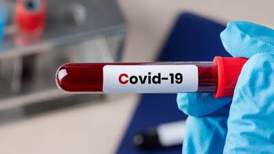 50 человек заразились коронавирусом за сутки в Казахстане