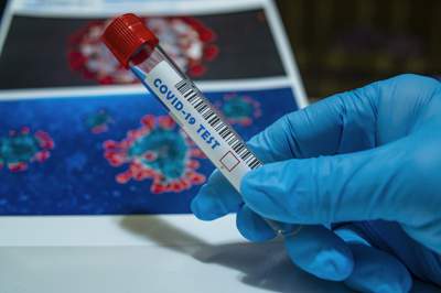 частные лаборатории могут диагностировать коронавирус без получения разрешения